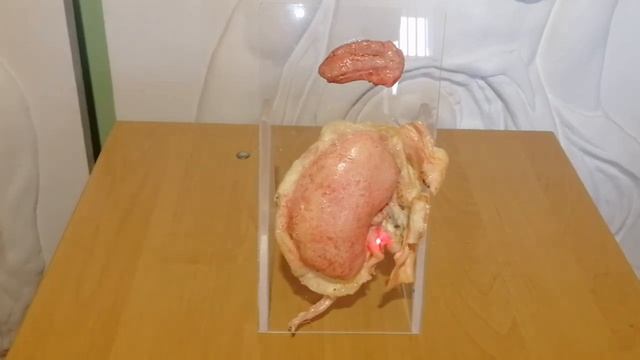 Почки смотреть онлайн