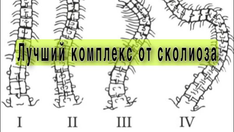 Полный Комплекс При Сколиозе Любой Степени. смотреть онлайн