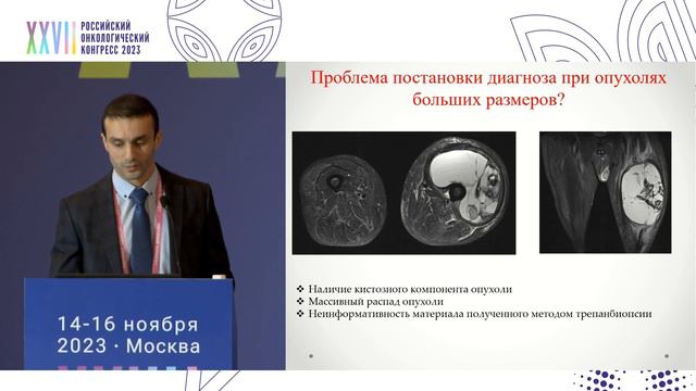 Биопсия сарком: пункционная или открытая смотреть онлайн