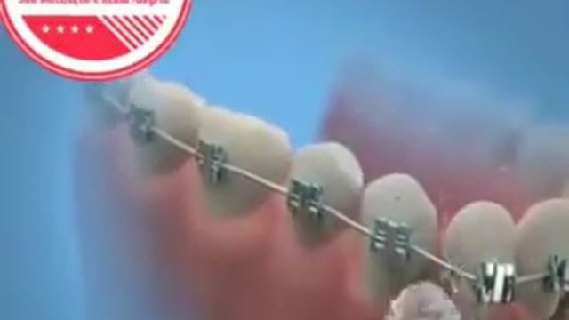 Torneira Water Flosser Irrigador Dental Oral Higiene Bucal смотреть онлайн