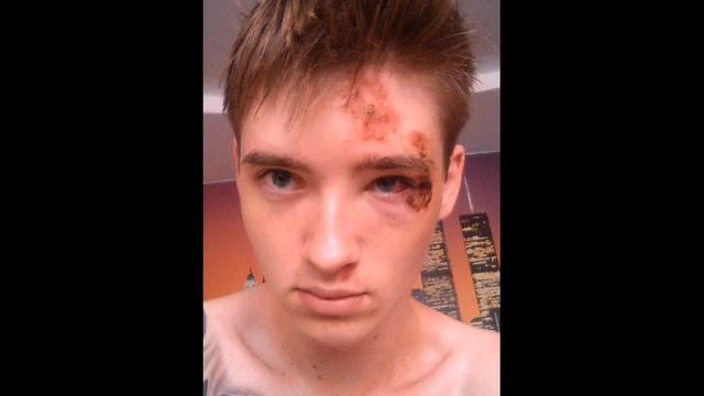 МАКС ВАЩЕНКО РАЗБИЛ ЛИЦО ОБ АСФАЛЬТ 7 ЛЕТ НАЗАД смотреть онлайн