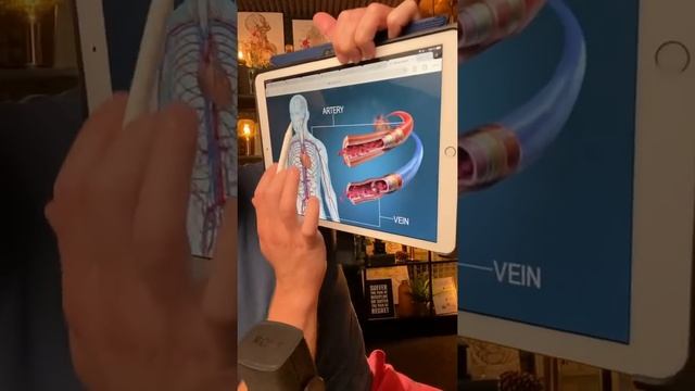 Крутит ноги, что делать? Синдром Беспокойных Ног! смотреть онлайн