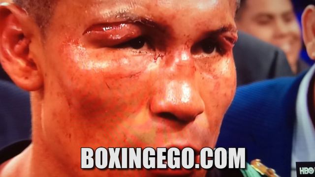 HBO: FRANCISO VARGAS VS ORLANDO SALIDO FULL FIGHT EPIC WAR BLOOD GUTS COMPLETE REVIEW смотреть онлайн