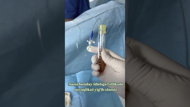 ?Ankalife EKU klinikamizda operasiya jarayoni смотреть онлайн