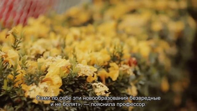 Назван заметный на лице признак опасного уровня холестерина