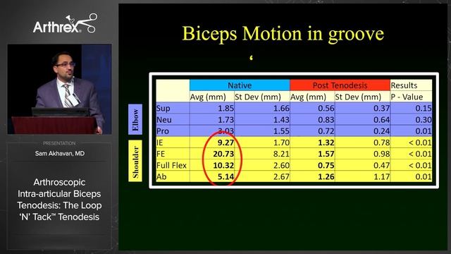Arthroscopic Intra-articular Biceps Tenodesis: The Loop 'N' Tack™ Tenodesis смотреть онлайн