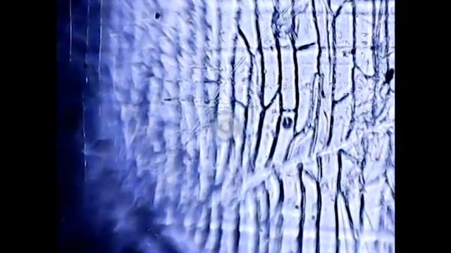 Видео с микроскопа смотреть онлайн
