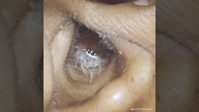 под микроскопом смотреть онлайн