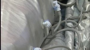 Прессотерапия и обертывание