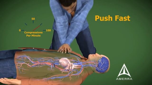 CPR Cardiopulmonary Resuscitation - 3D Animation