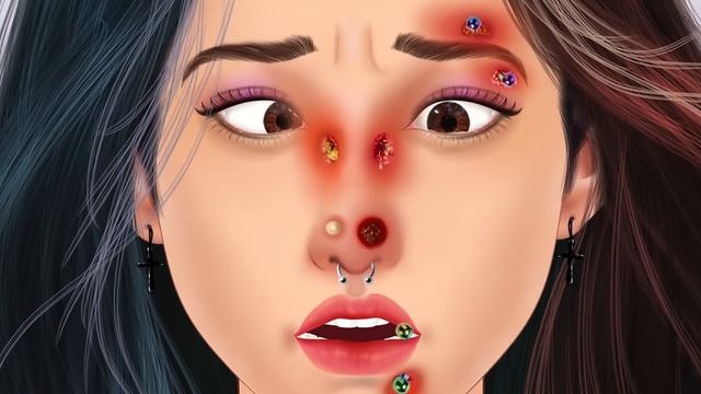 ASMR Treatment of infections caused by wearing facial piercings - 얼굴 피어싱 착용으로 인한 감염 치료 смотреть онлайн