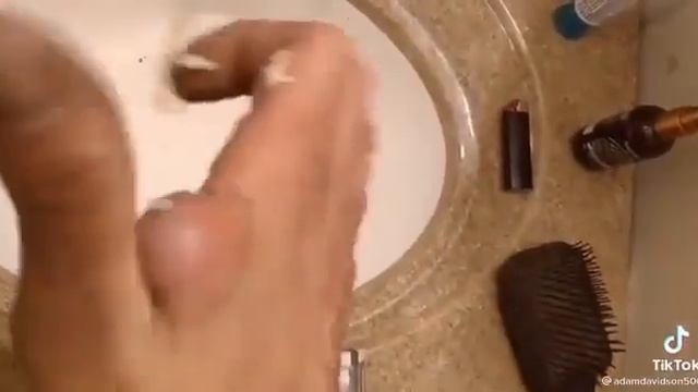 Чистка Кожи у Косметолога. Выдавливание Прыщей. Удаление Черных Точек и Угрей. 2022 - №74 смотреть онлайн