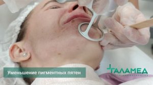 Лазерная СО2 шлифовка в Центре косметологии Галамед
