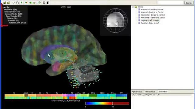 Tutorial: Brain Explorer® 3-D Viewer for the Allen Human Brain Atlas смотреть онлайн