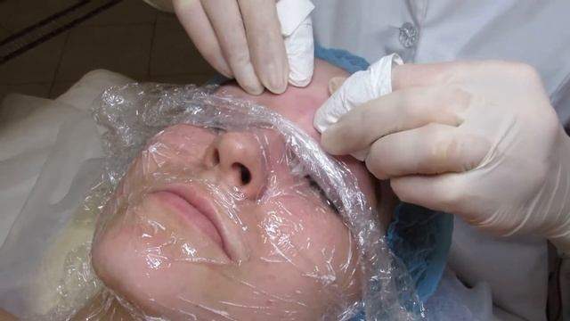 Комбинированная чистка лица на Оболони в BEAUTY SPA CENTER "IMPULSE" смотреть онлайн