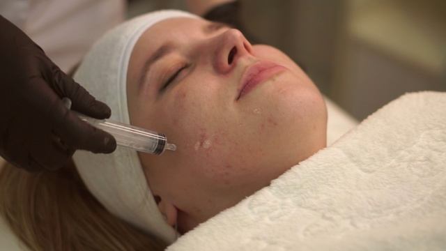 Новинка нашего медицинского центра PeelArm force PRC Classic FINISTERE! смотреть онлайн