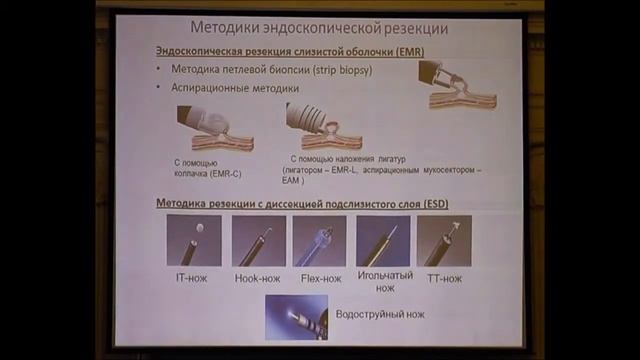 03 Кашин СВ Современные методики эндоскопического лечения раннего рака желудка смотреть онлайн
