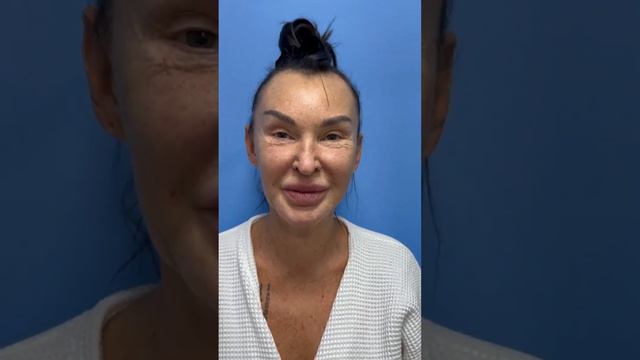 Омоложение лица смотреть онлайн