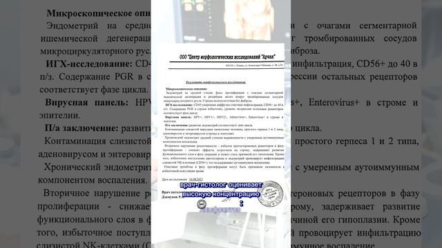 Рубрика «Мнение эксперта». КСМ Казань. ЭКО по ОМС. #экопоомс#пайпельбиопсия#эндометрий#бесплодие смотреть онлайн