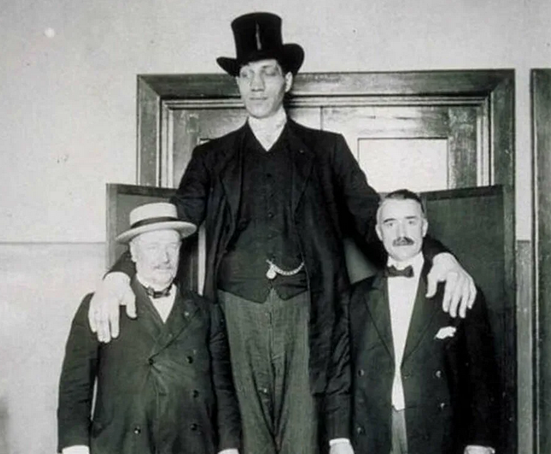 Фёдор Махнов - великан ростом 285 см смотреть онлайн