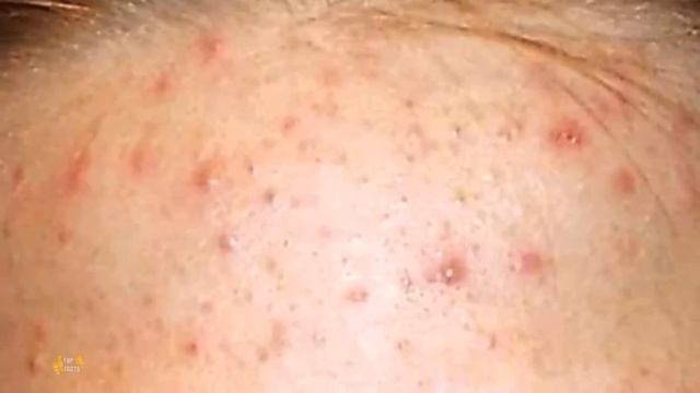 Как сделать кожу лица гладкой и чистой? смотреть онлайн