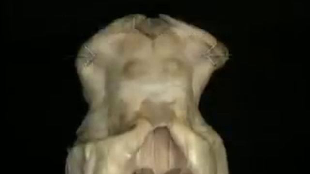 Анатомия человека. Головной мозг. смотреть онлайн