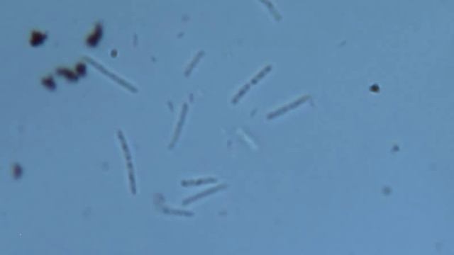 Bacillus (бациллы) под микроскопом смотреть онлайн