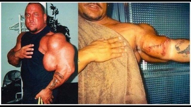 Почему Качки Используют Синтол? смотреть онлайн