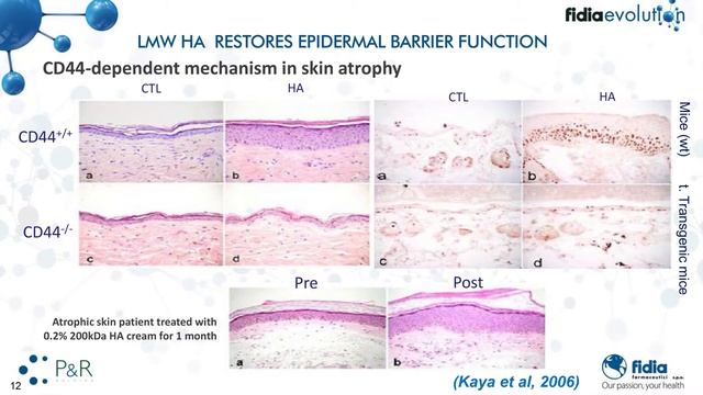 Концепция роли молекулярного веса и биологическом действии гиалуроновой кислоты. Карло Соранцо.