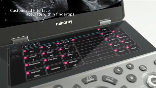 Портативный УЗИ аппарат Mindray MX7 смотреть онлайн