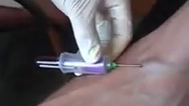 Венепункция. Анализ крови из вены. смотреть онлайн