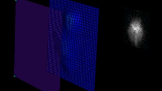 Stanford Hospitals & Clinics: laser vision correction: wavefront LASIK смотреть онлайн