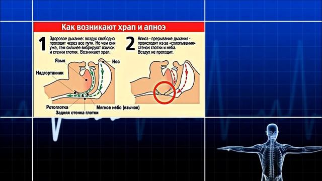 Какая категория людей наиболее подвержена храпу? смотреть онлайн