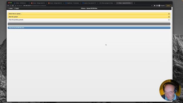 Orthanc PACS for beginners #3 - Creating users, uploading and viewing DICOM images смотреть онлайн