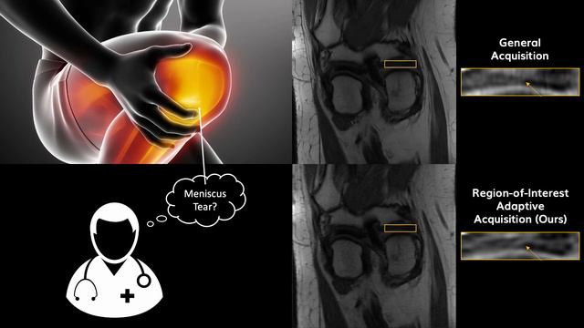 Poster 45. Region-of-Interest Adaptive Acquisition for Accelerated MRI смотреть онлайн