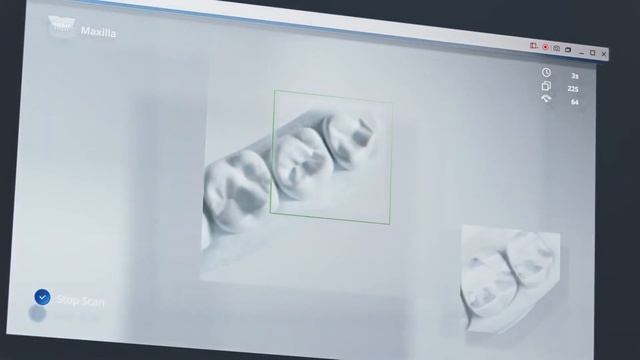 Medit i700 #Intraoralscanner Aussehen - Ortho Organizers GmbH смотреть онлайн