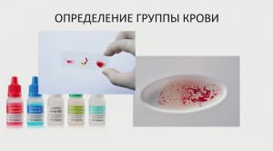 Физиология крови. Часть 3. Группы крови.