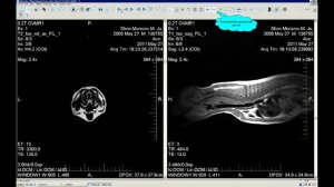 Работаем с eFilm Lite_