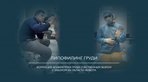 Липофилинг груди и липосакция живота