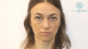 Лифтинг полоски Eye Lift Secret для коррекции век