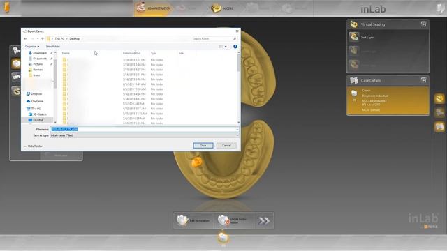 How to: Import Cerec to Exocad/3Shape смотреть онлайн