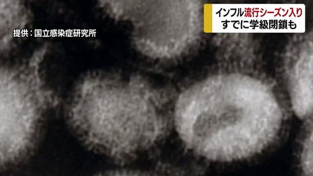 愛媛県でインフルエンザ流行期入り 昨年より2か月早く смотреть онлайн