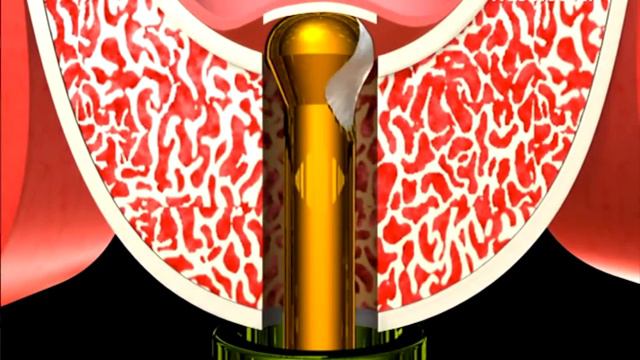 Kit SCA – IM3 смотреть онлайн