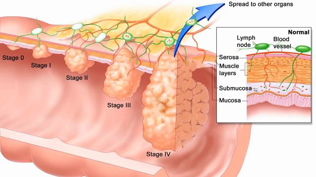 Фитиновая Кислота (Фитаты) Вред или Польза? Доктор Майкл Грегер смотреть онлайн