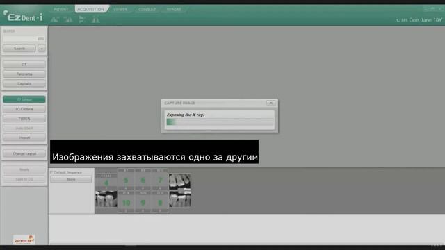 04 Получение снимков с визиографа в программе EzDent-i смотреть онлайн
