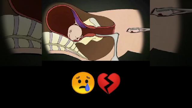 Вот что значит аборт😡