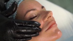 Процедура пилинга PRX-T33