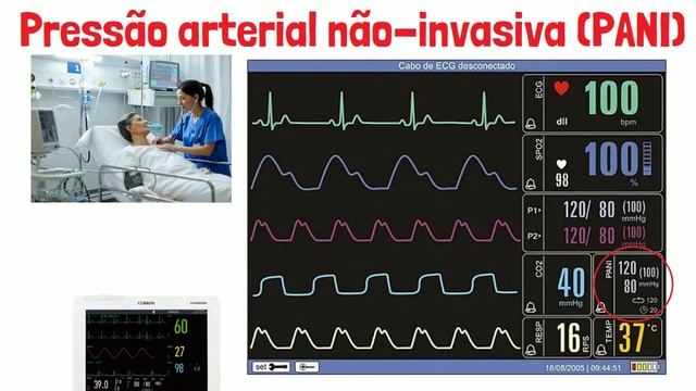 Monitorização Multiparamétrica no paciente crítico смотреть онлайн
