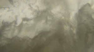 Человеческий ноготь под микроскопом