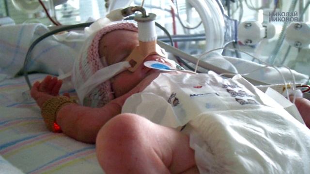 Bronchopulmonary dysplasia and children who are very premature. смотреть онлайн